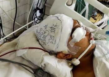 ঘটনা মর্মান্তিক….হাড় নেই, চাপ দেবেন না’ (প্রথম আলো অনলাইন)