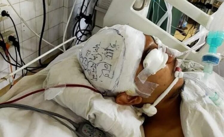 ঘটনা মর্মান্তিক….হাড় নেই, চাপ দেবেন না’ (প্রথম আলো অনলাইন)